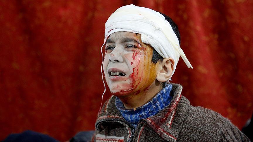 سال ٢٠١٨ بیش از چهار هزار نفر غیر نظامی به دست نیروهای رژیم اسد کشته شدند